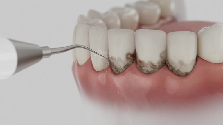 Trusted Teeth Cleaning And Checkup service in Riverside, IL - Dentist Open Now